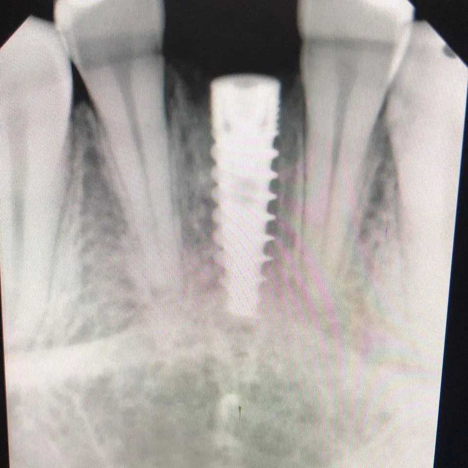 Cosmetic dentistry results at SmileSpace